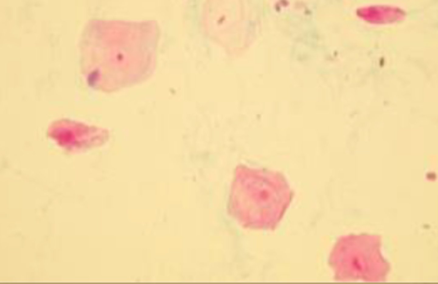 <p>- Originates from vagina, vulva or prepuce</p><p>- Distal urinary system</p><p>- Largest epithelial cells</p><p>- Flat, irregular shaped, small round nucleus</p><p>- Not a significant finding</p>