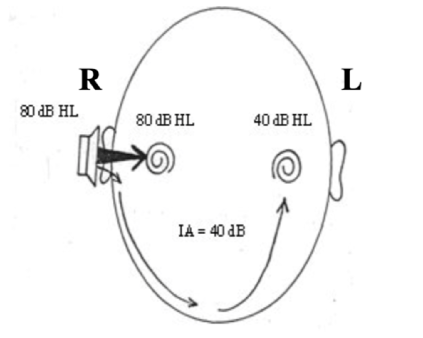 <p>- the loss of sound energy (and thus intensity) as it crosses from the test ear to the non-test ear.</p><p>- an air conducted signal will lose at least 40 dB.</p><p>- IA for AC = 40 dB</p>