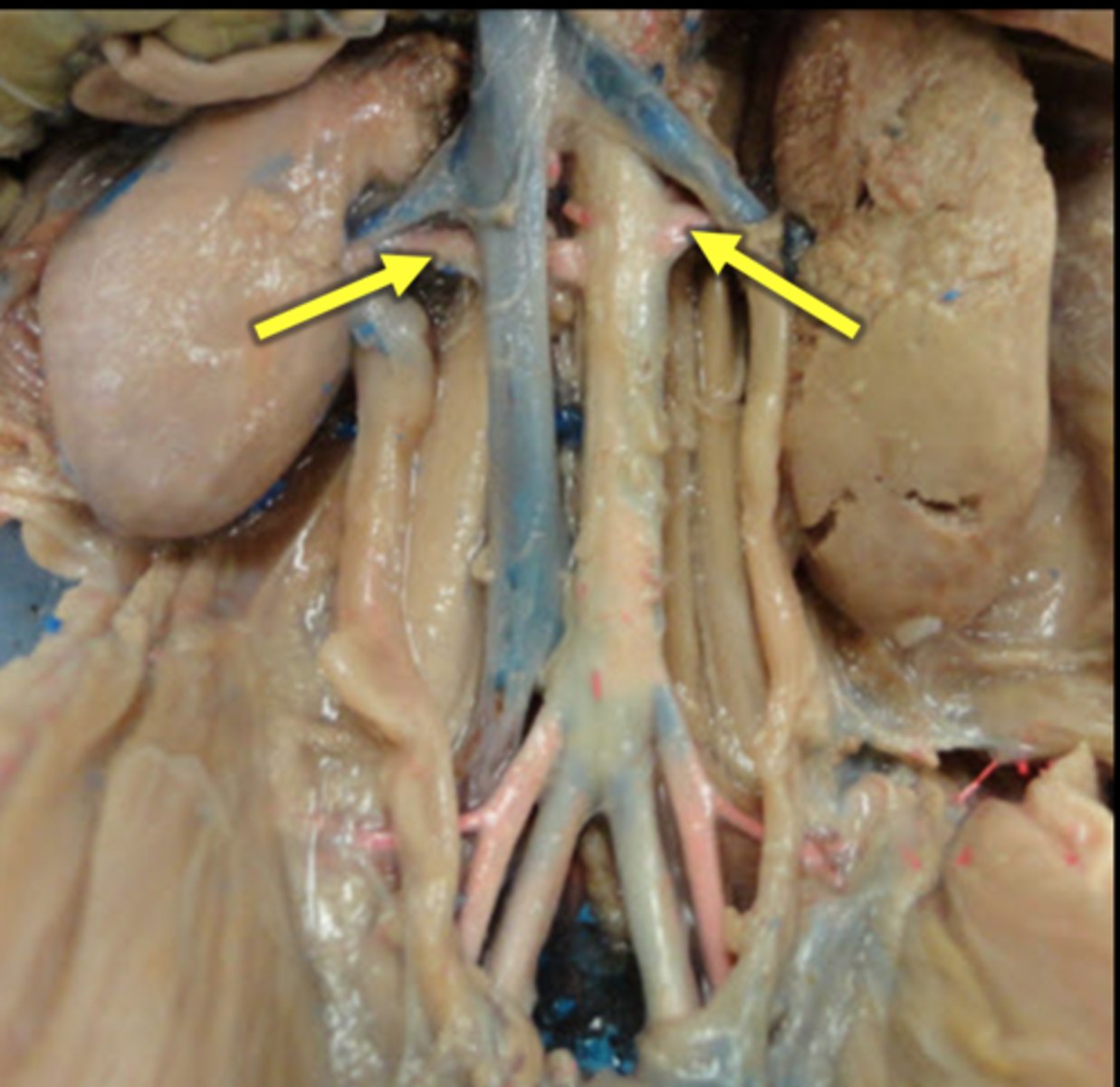 <p>Renal arteries</p>