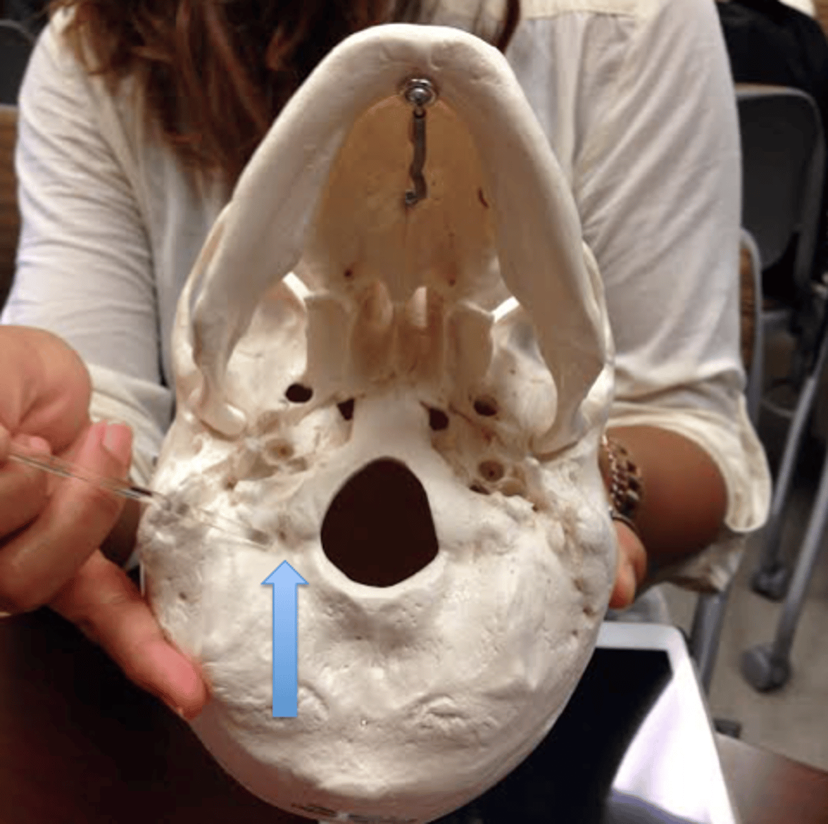 <p>ectocranial depressions immediately posterior to the condyles, receive posterior margin of superior facet of C1</p>
