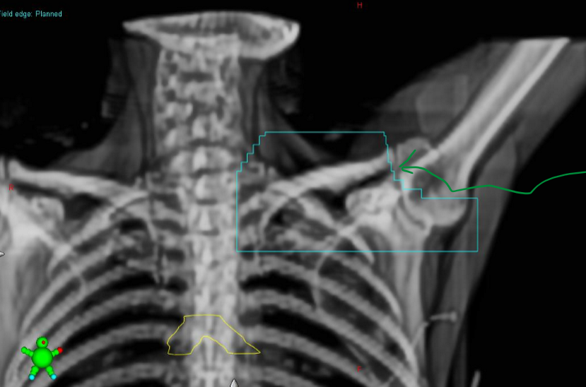 <p>on a supraclav BEV, what three thing are we assessing?</p>