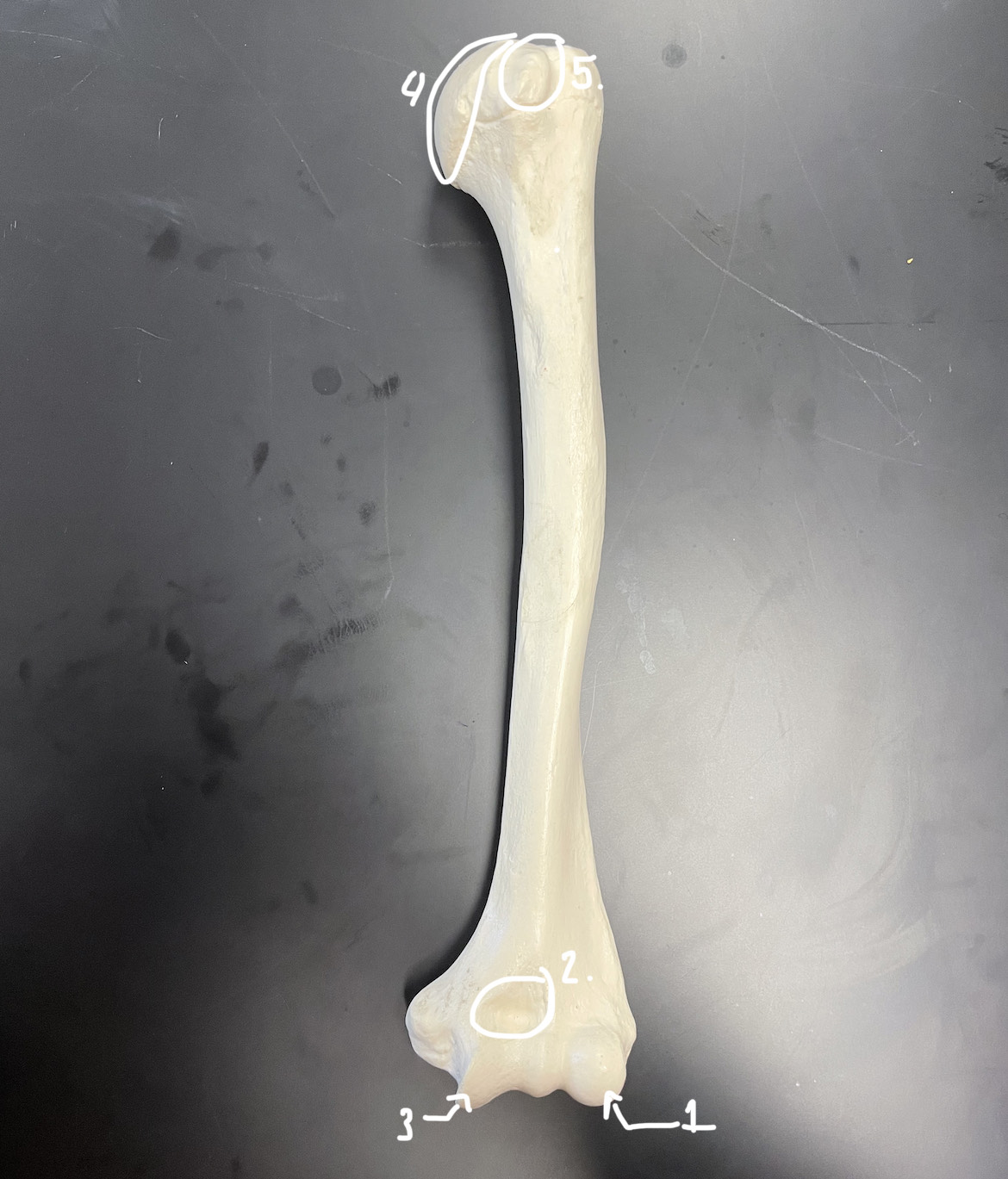 <p>greater tubercle</p>