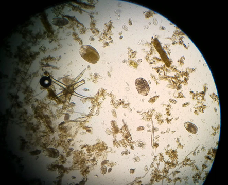 rumen protozoa in fluid