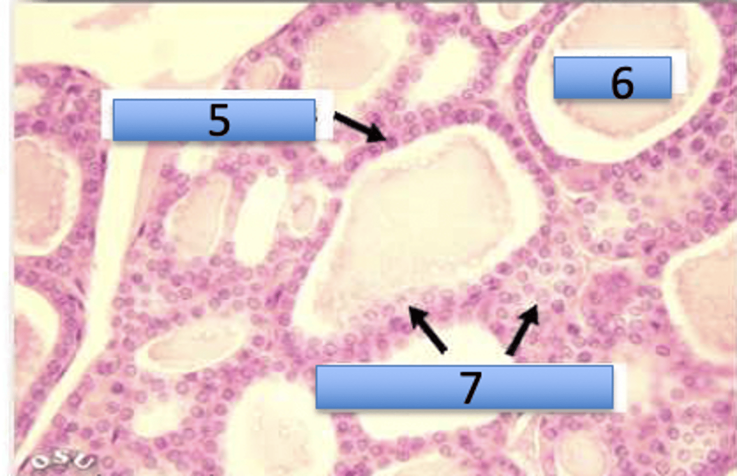 <p>Thyroid gland</p><p>5. Principal cells</p><p>6. Colloid</p><p>7. Parafollicular cells</p>