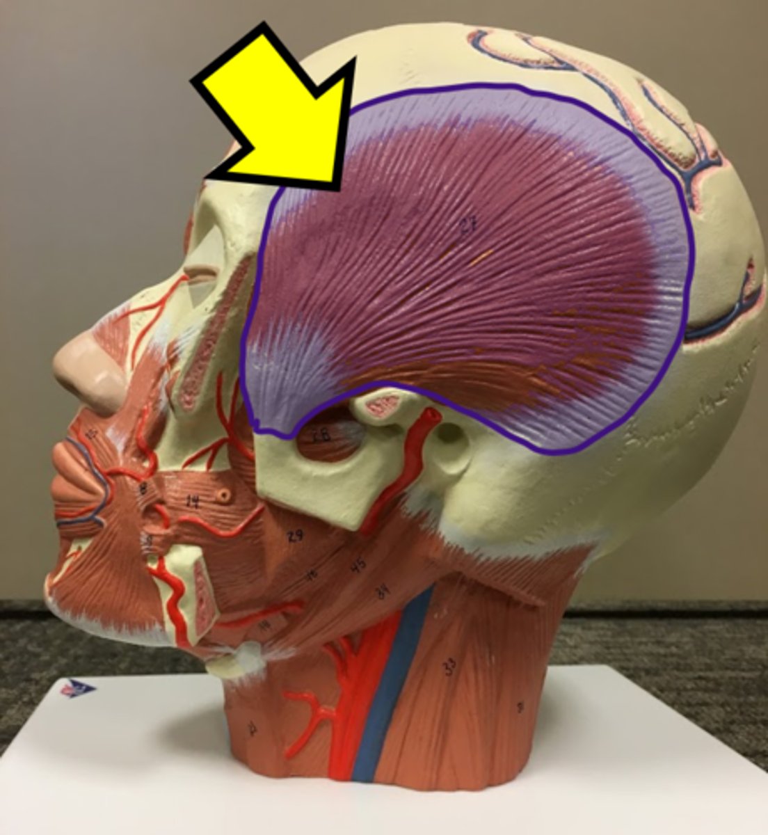 <p>Name the muscle.</p>