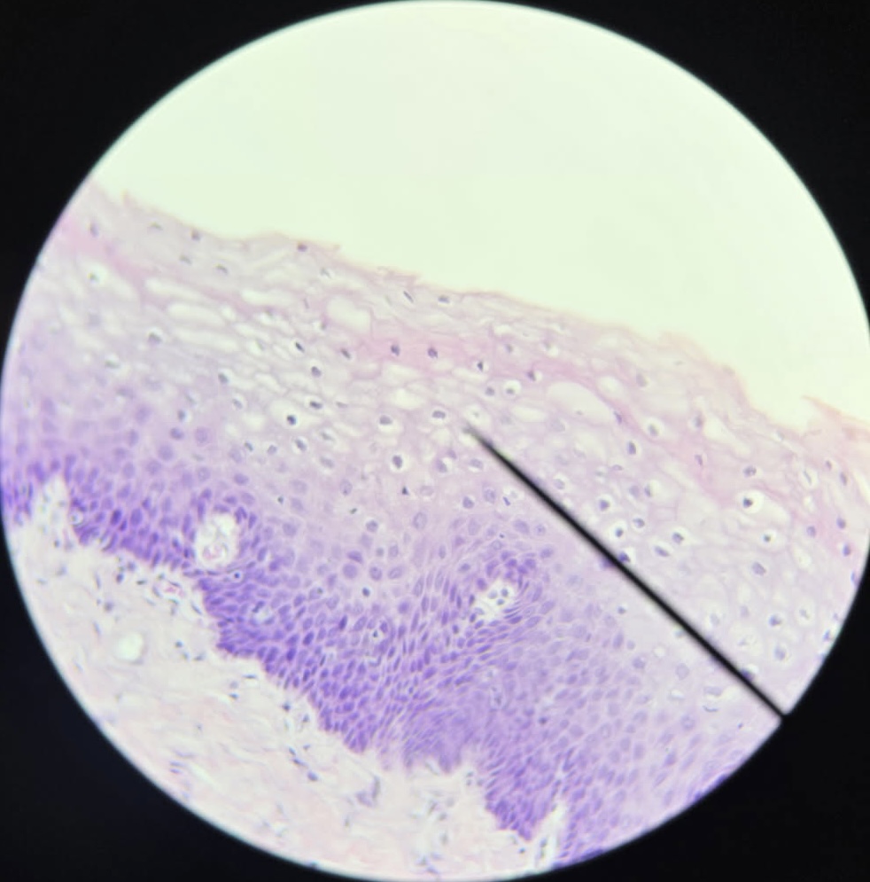 <p>Non-keratinized Stratified Squamous Epithelium</p>