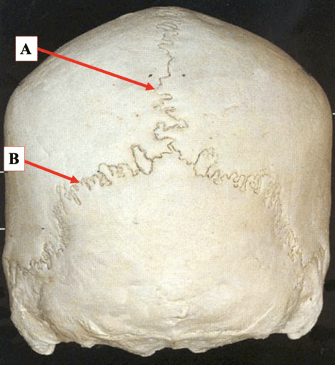 <p>Identify B.</p>