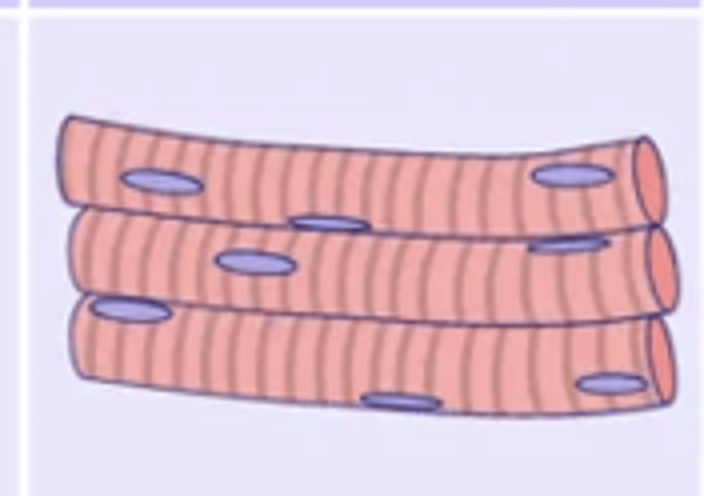 <p>- Most common type</p><p>- Usually attached to bones via tendons (some, like facial muscles, are not)</p><p>- Controls joint movement under voluntary control</p><p>- Fibres are striated, tubular, and multi-nucleated</p>