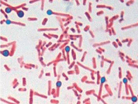 Clostridium tetani