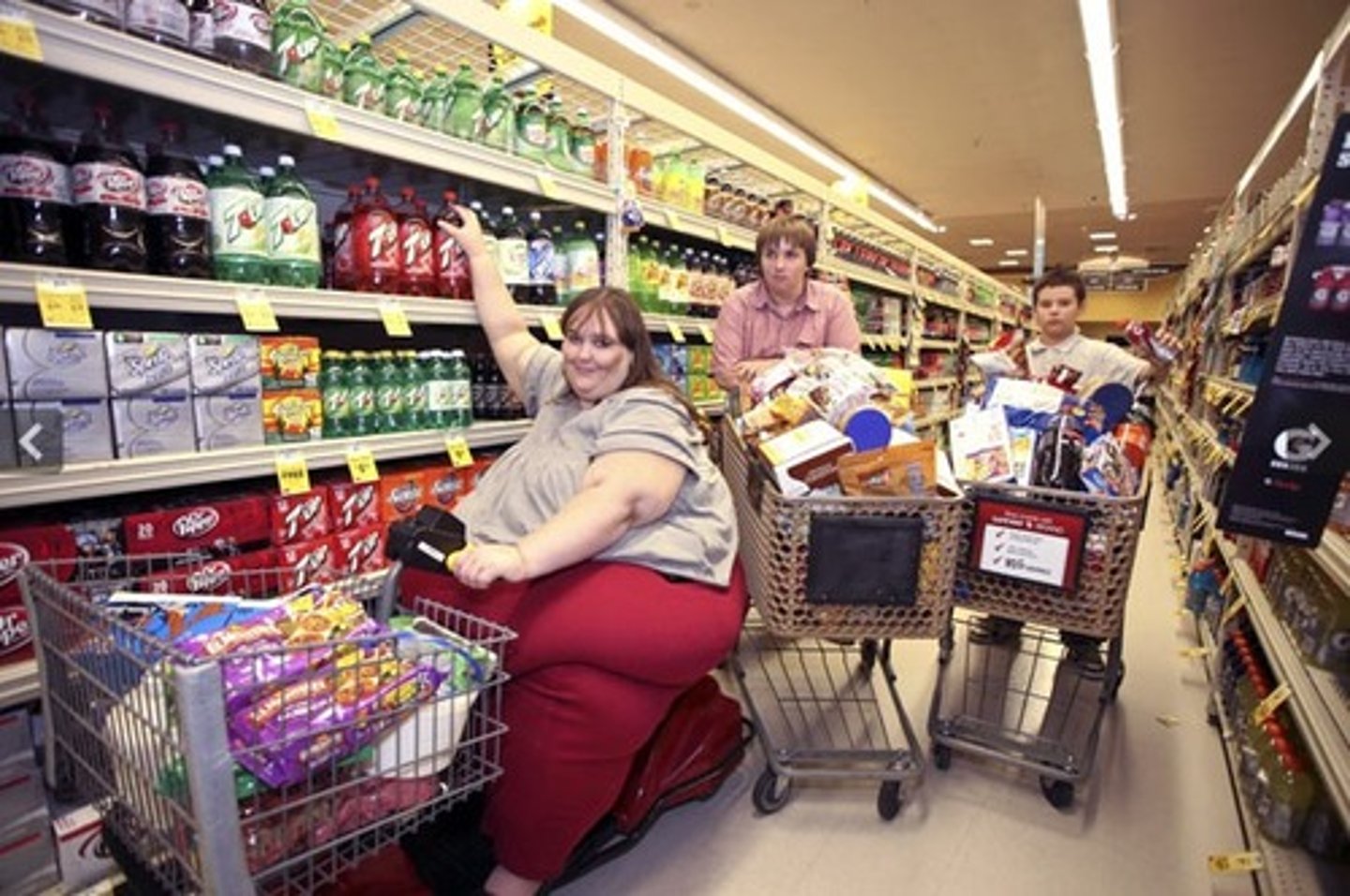 <p>Ingestion of too many calories and a lack of balance of foods and nutrients.</p>