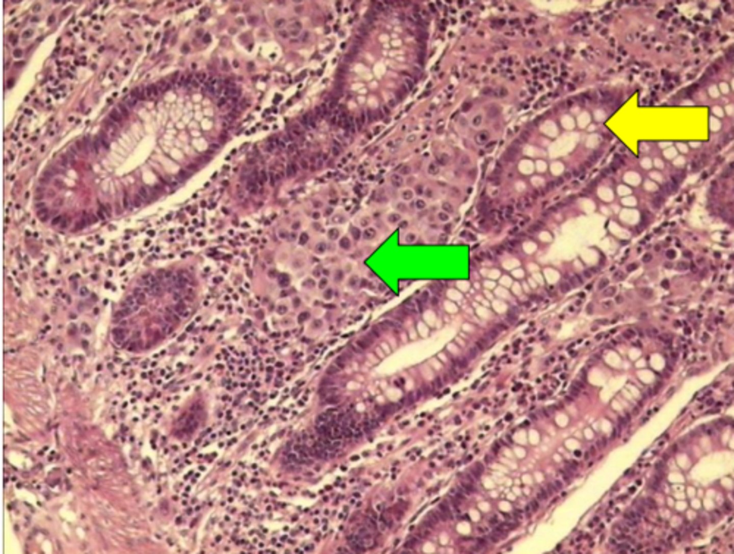 knowt flashcard image