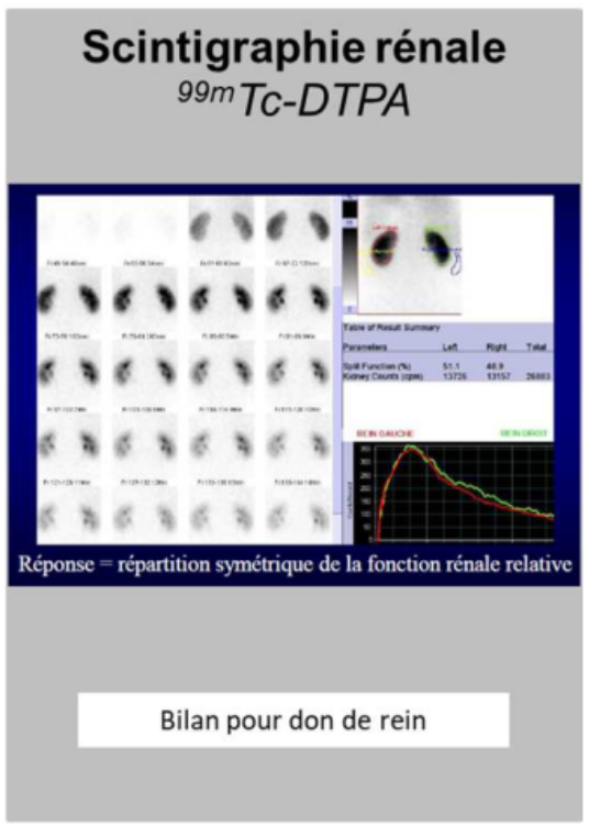 <ul><li><p>On peut faire <strong>des scintigraphies rénales</strong> avec le technétium 99 métastable pour voir si on n’a pas d’occlusions au niveau des artères par exemple</p></li></ul><p></p>
