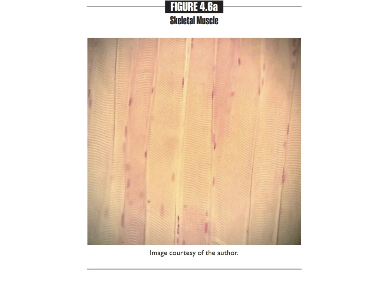 <p>Skeletal Muscle Tissue </p>