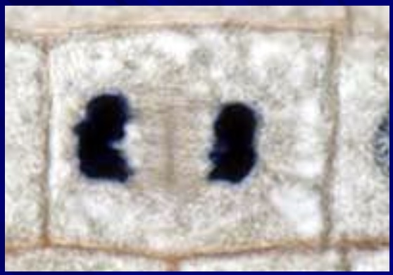 <p>what phase is this cell in&nbsp;</p>