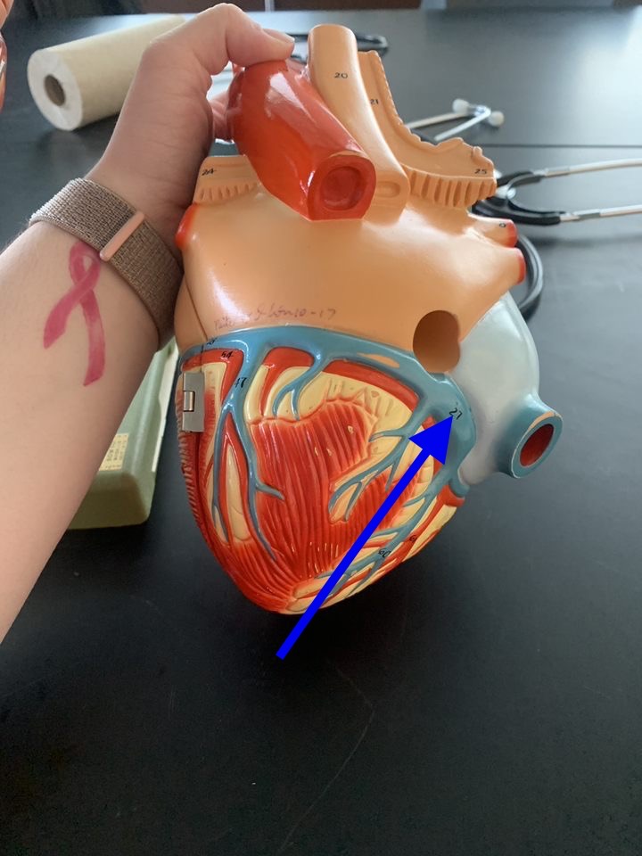 Name the heart structure.