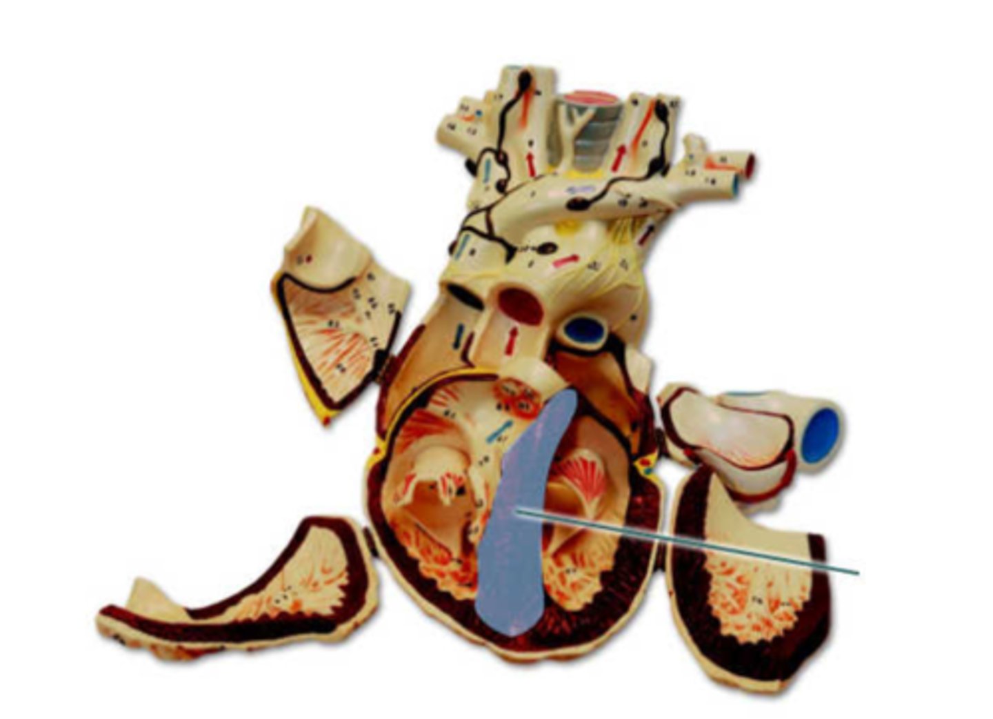 <p>interventricular septum</p>