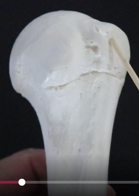 <p>in the head of the humerus</p><p></p><p>a lateral bump on the proximal end of the humerus that serves as an attachment site for muscles hat move the arm</p>