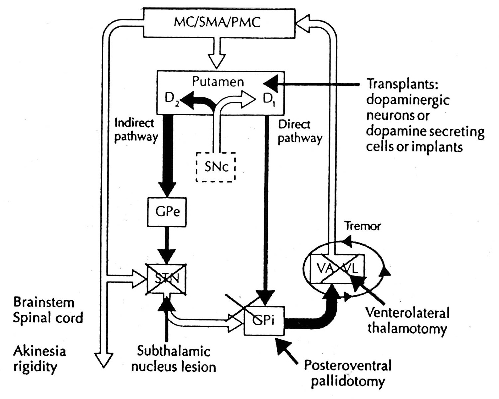 <p>the anatomy of the basal ganglia has prompted several strategies for treating parkinson’s disease</p>