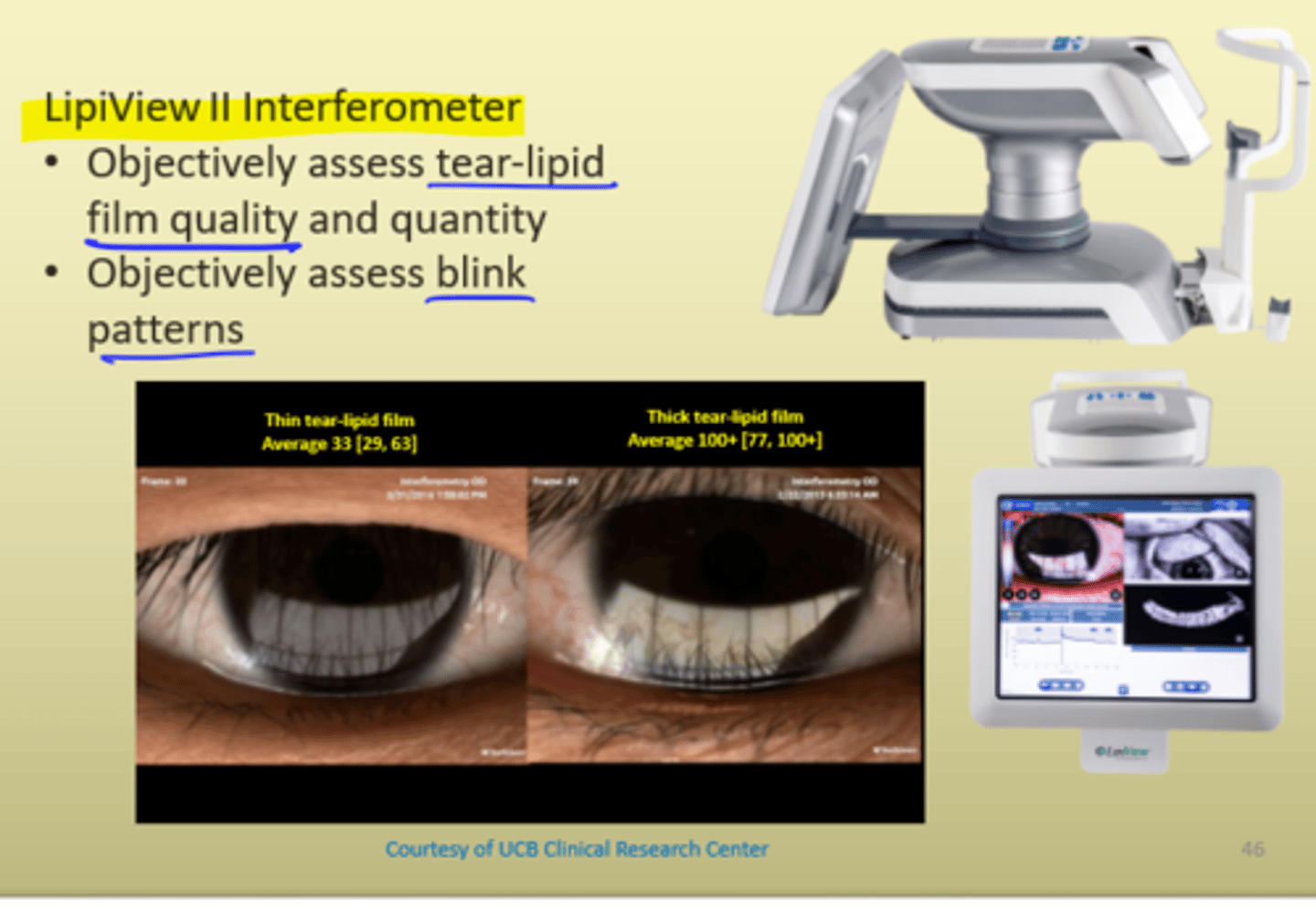 <p>Lipiview II Interferometer</p><p>- Objectively assess tear-lipid film quality and quantity</p><p>- Objectively assess blink patterns</p><p>- Normal tear film: 40-80</p><p>- Combo of tear composition and thickness</p>