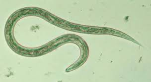 <p>what parasite is this</p>