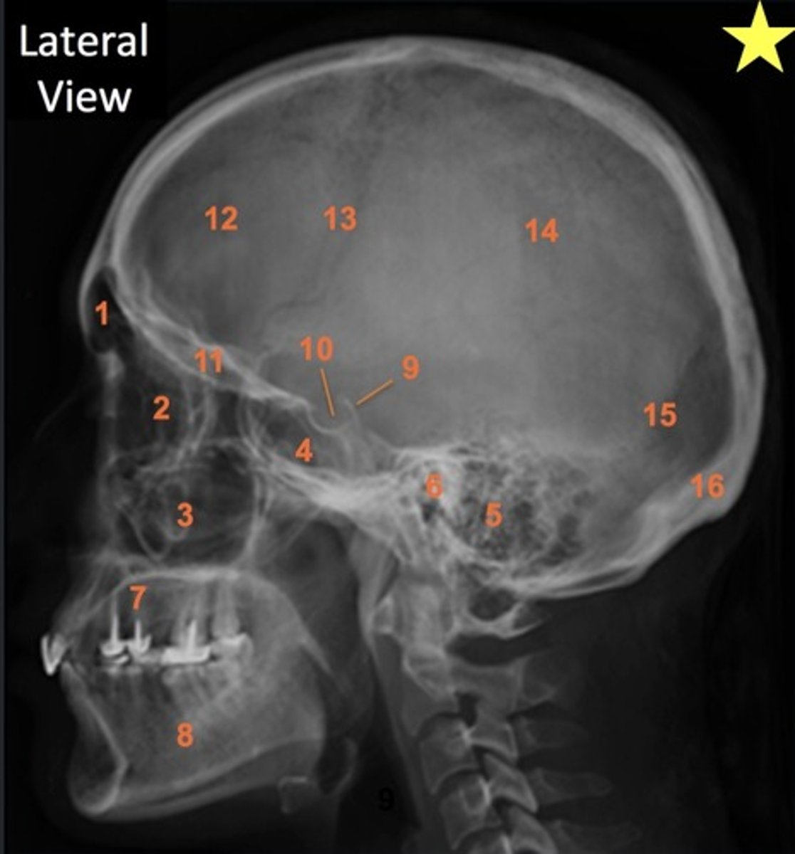 <p>Match the following structures to their corresponding numbers in order: Frontal sinuses, ethmoid sinuses, maxillary sinuses, and sphenoid sinuses</p>