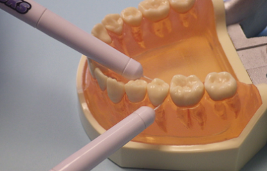 <p><strong>May be more effective in establishing a regular flossing habit in non-flossers than finger-manipulated flossing; When can it be recommended?</strong></p><p><strong>A variety of floss-holder designs are available; some are pre-threaded, one-time use and others aren’t</strong></p><p>Helpful for people with a disability or for parent/caregiver </p><p>Should not displace the tissue during proper use</p><p>Two handle flossing system (Gumchucks) increases control and dexterity (helpful for young children to make the C shape) </p>