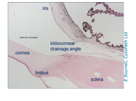 <ol><li><p>Iris (top)</p></li><li><p>Iridocorneal drainage angle (middle)</p></li><li><p>Cornea (bottom left)</p></li><li><p>Limbus (bottom middle)</p></li><li><p>Sclera (bottom right)</p></li></ol><p></p>