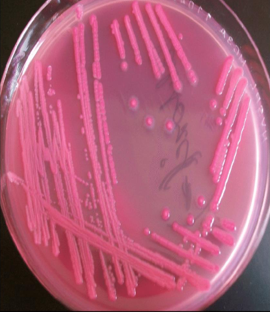 <p>Какво е характерно за Е. coli?</p>