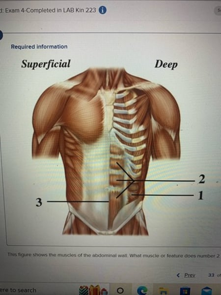 <p>Rectus abdominis</p>
