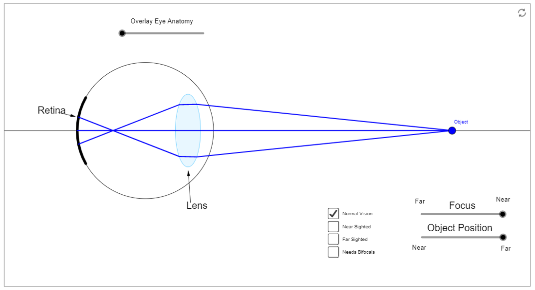 <p>glasses are either concave or convex and they correct the aberrations in your eye!</p>