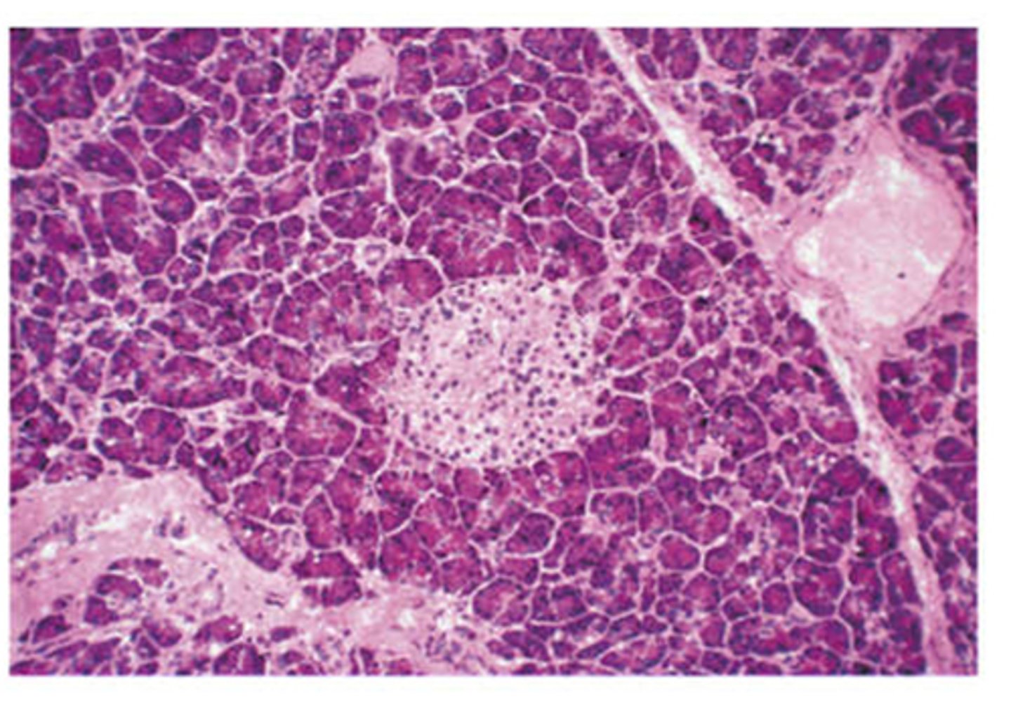 <p>Consists of exocrine cells and endocrine cells</p>