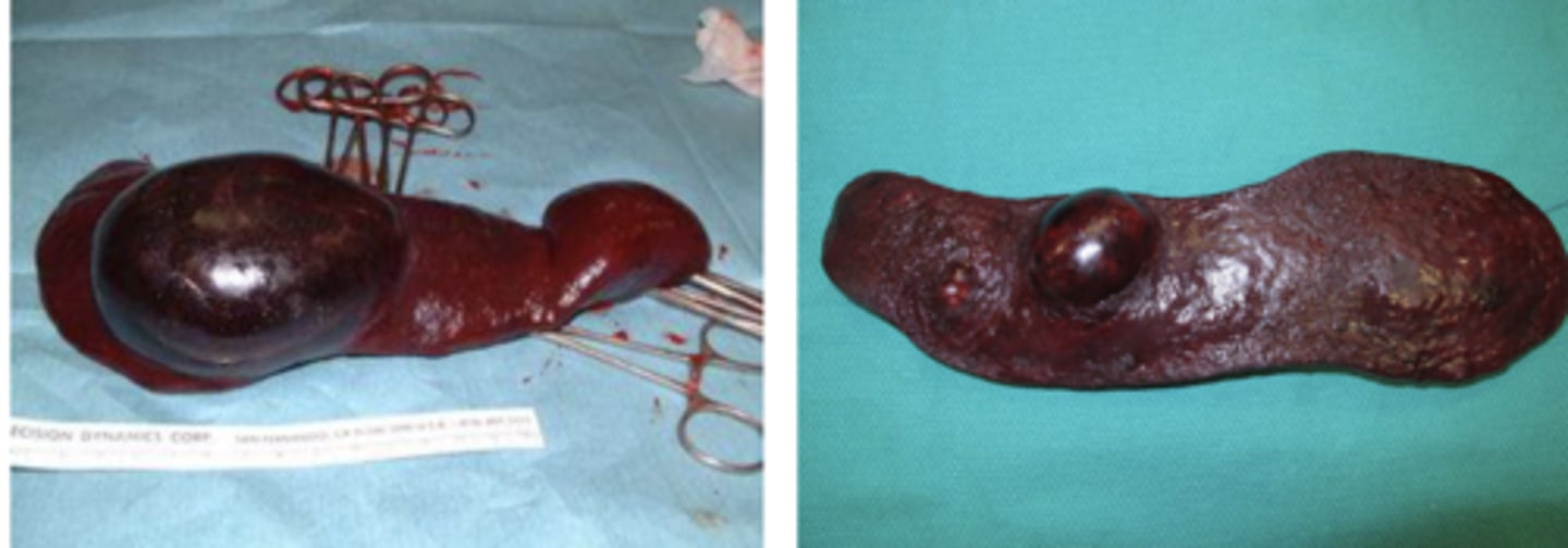 <p>Are these masses a hemangioma or hemangiosarcoma?</p>
