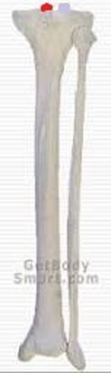 <p>forms the medial part of the INTERCONDYLAR EMINENCE</p>