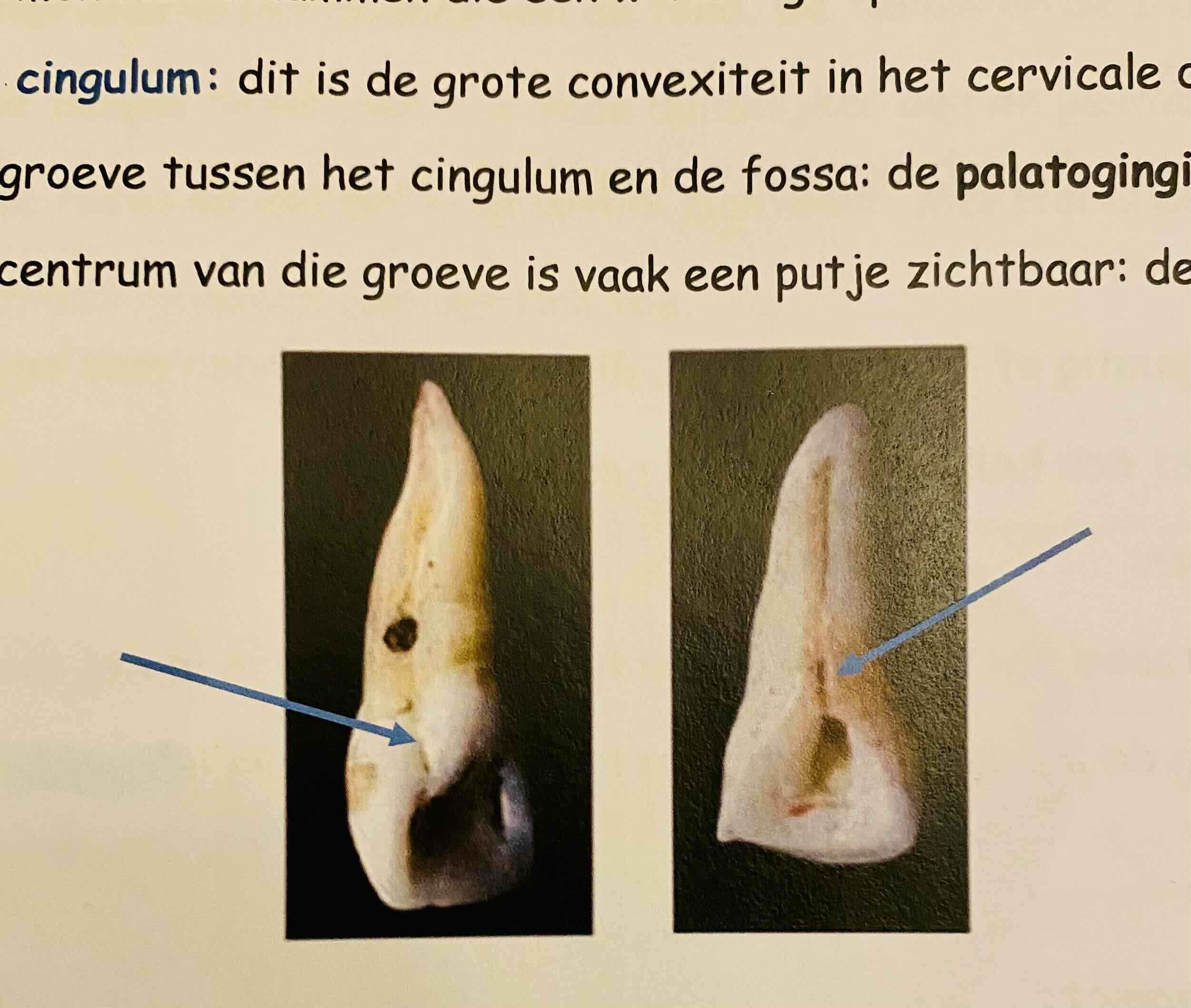 <p>Wat is een palatogingivale groeve?</p>