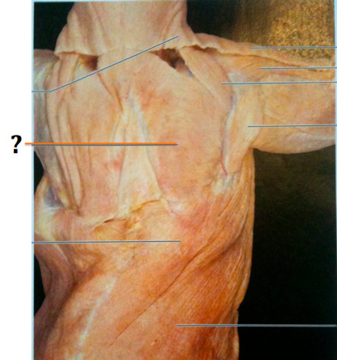 <p>Origin: spines of cervical vertebrae</p><p>Insertion: spine of scapula</p><p>Action: pulls scapula dorsally</p>