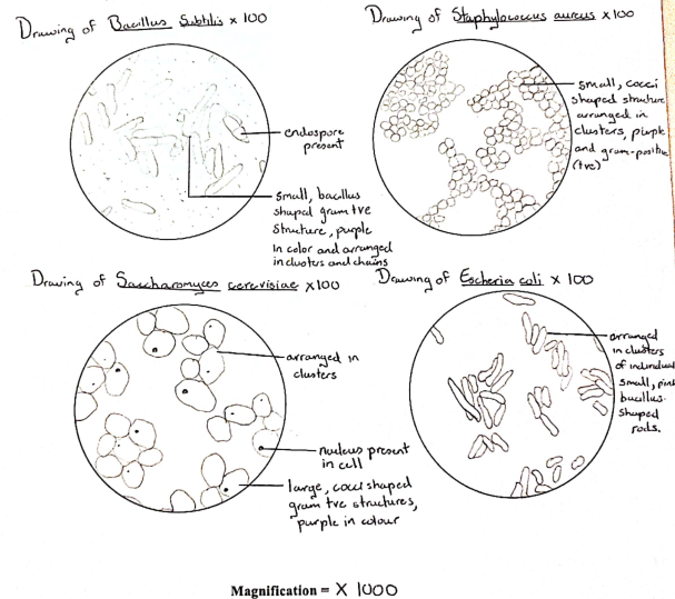 Drawing of gram +ve or gram -ve bacteria