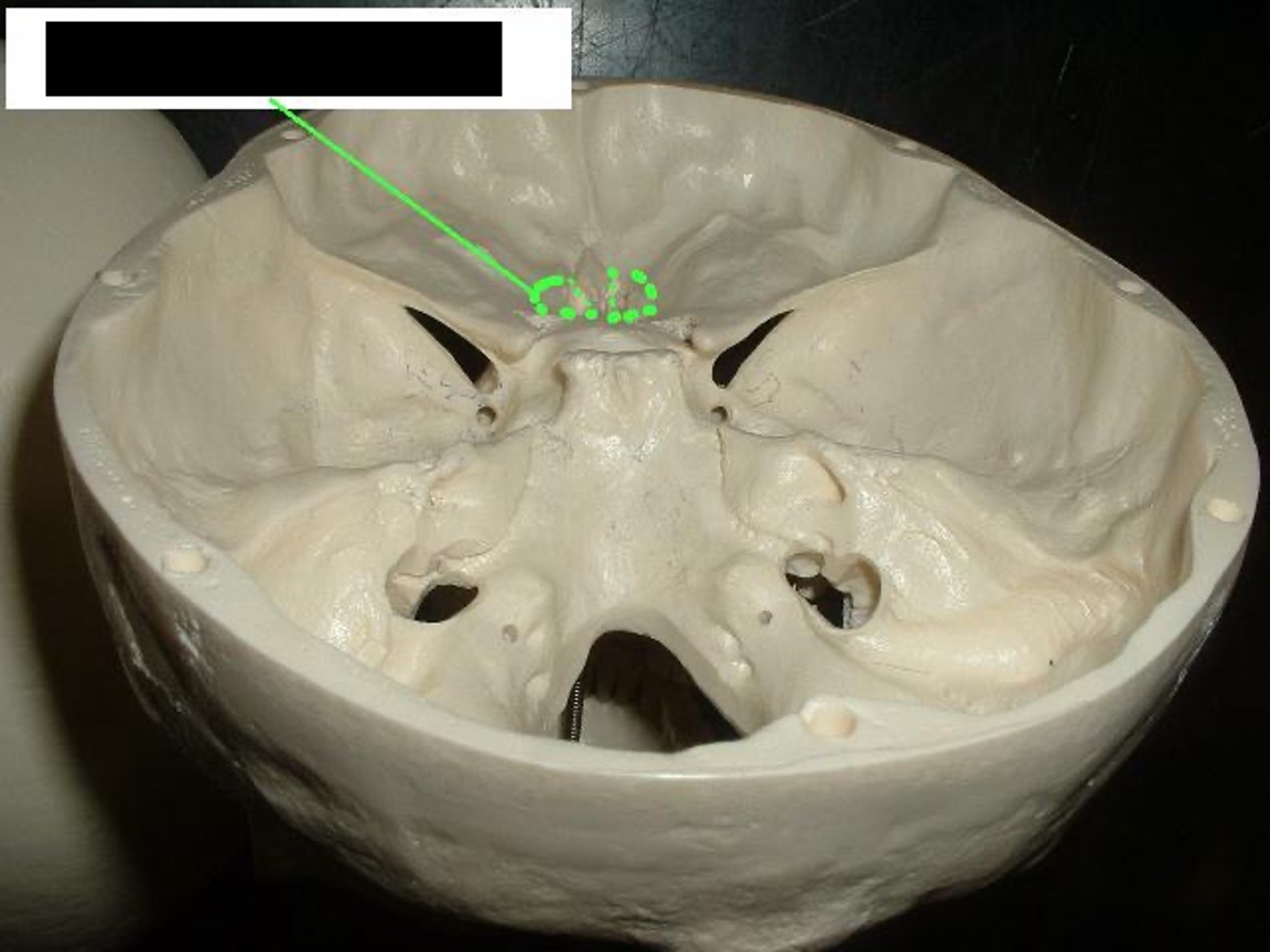 <p>to the left and right of the Crista Galli (concave)</p>