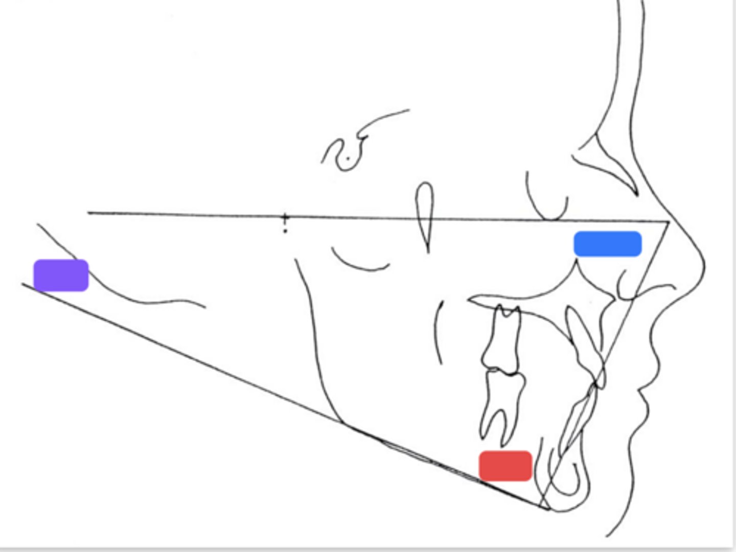 <p>What is the angle indicated at the red box?</p>