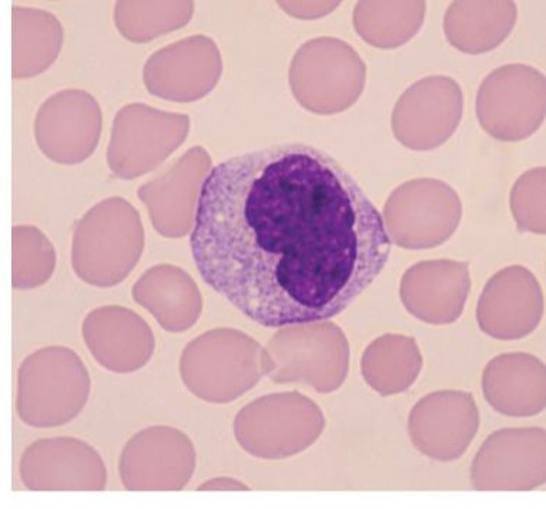<p>which leukocyte is this?</p>