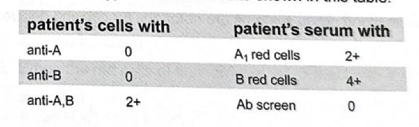 <p>A patient is typed with the results shown in the table. The most probable reason for these findings is that the patient is group:</p><p>a O; confusion due to faulty group O antiserum</p><p>b O; with an anti-A1</p><p>c Ax; with an anti-A1</p><p>d A1; with an anti-A</p>