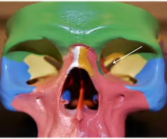 Narrow, slitlike opening