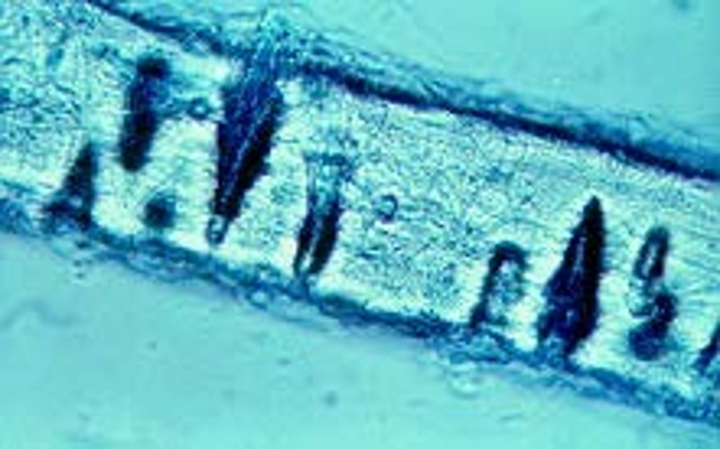 <p>-Trichophyton mentagrophytes (+) vs T. rubrum (-think)</p><p>-take hair, autoclave it, and then place fungus in tube</p><p>-incubate at room temp for 4 weeks and look weekly for + reaction</p><p>MENTA: can have macroconidia but tonsurans can never have macroconidia</p><p>TONSURANS is more balloon-shaped and tear dropped. I think menta is more round conidia!</p><p>+ = endothrix (wedge, shaped performations cuased by hyphae penetrating hair)</p><p>- = ectothrix (fungal hyphae remain outside the hair shaft)</p>
