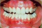 <ul><li><p>Covers the gingiva and hard palate</p></li></ul><ul><li><p>Firmly attached to underlying tissue </p></li><li><p>Not attached to free margin of the gingiva</p></li></ul><ul><li><p>Keratinized</p></li></ul><p></p>