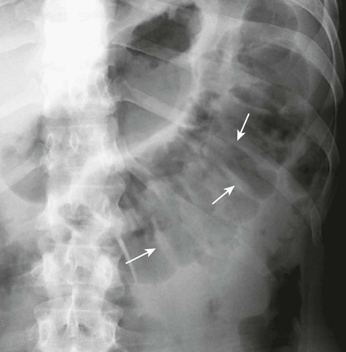 <p>What are the white arrows pointing to?</p>