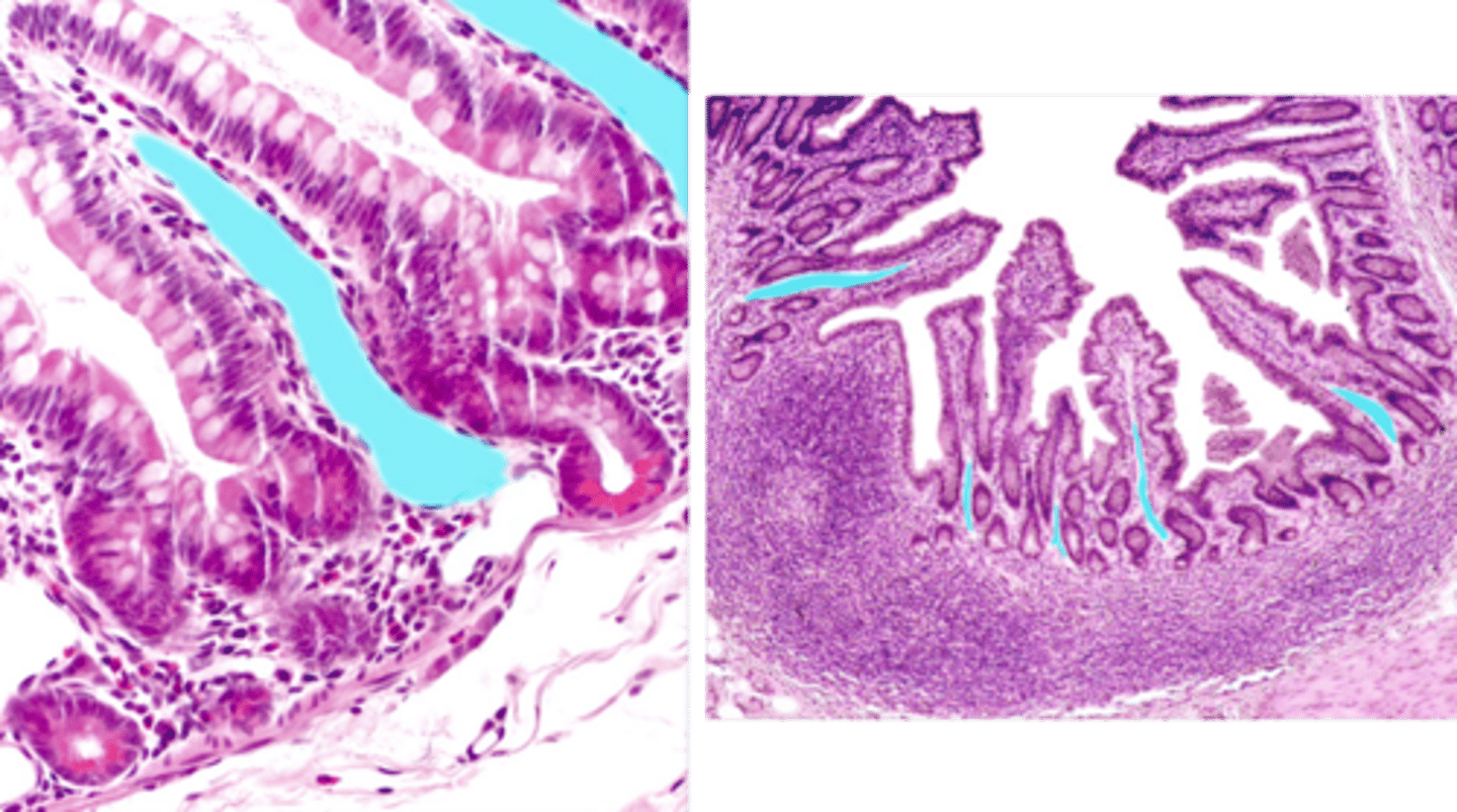 <p>Identify this lymphatic structure.</p>