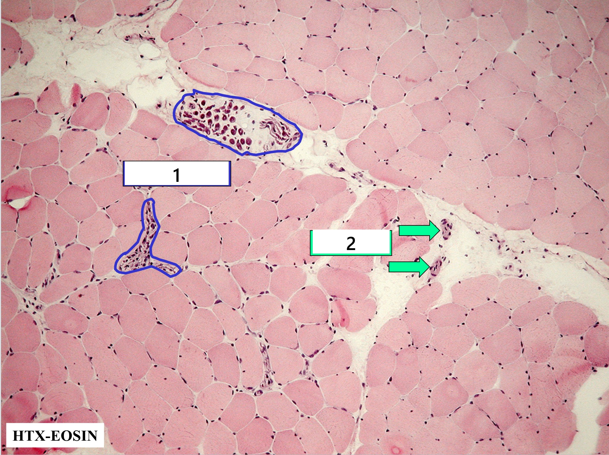 term image