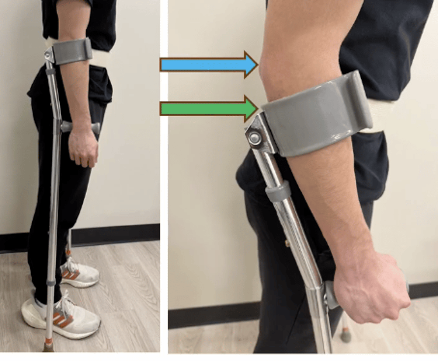 <p>- handle at ulnar styloid process</p><p>- top of cuff 1-1.5 inches from olecranon while holding hand grip</p>