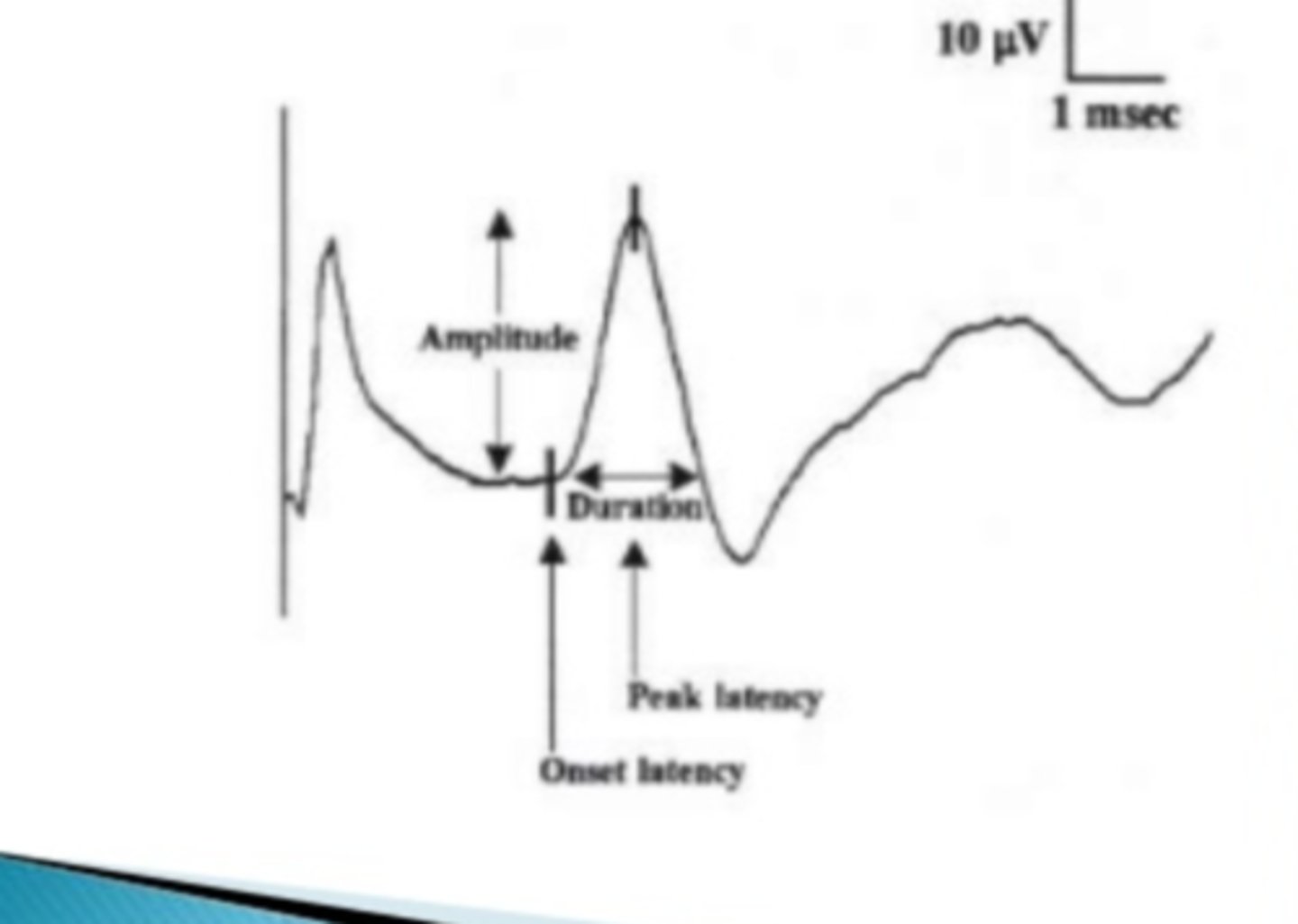 <p>sensory nerve action potential</p>