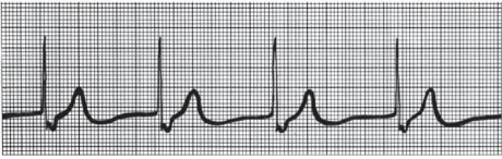 <p>What kind of rhythm is this? </p>