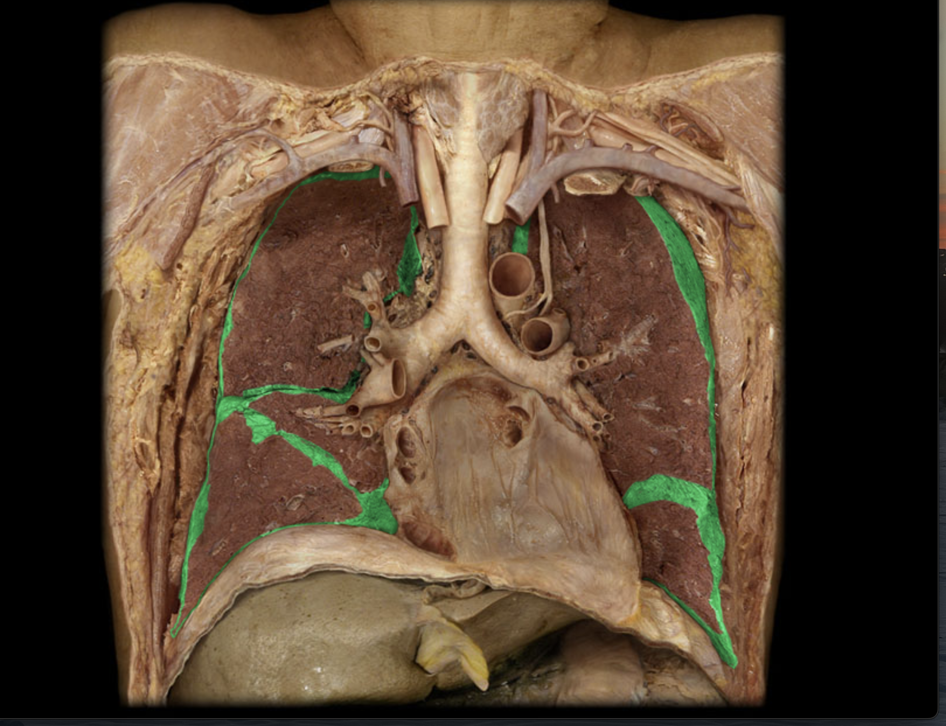 <p>Membrane covering the lungs </p>